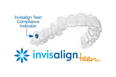 Инвизилайн подросток - имплантация зубов в индии